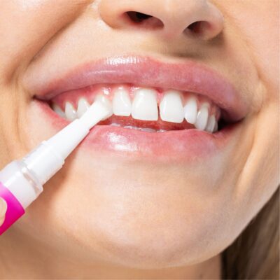 HISMILE PAP+ – Stylo Dentaire Correcteur de Couleur