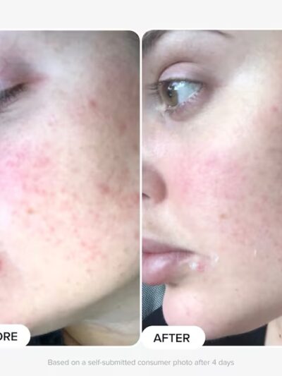 PAULA’S CHOICE
Boost – Booster 10% Acide Azélaïque